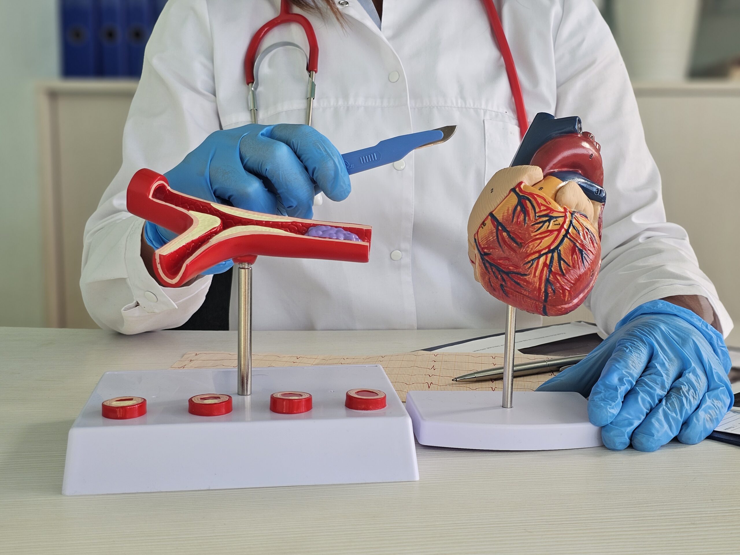 Angioplasty Doctor in Banashankari